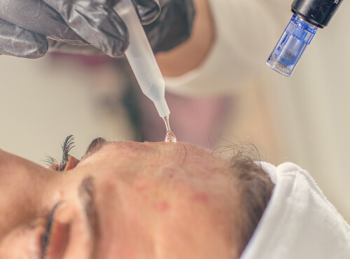 beautician cleans and prepares the skin