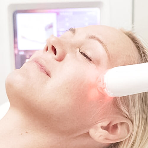 Virtue rf microneedling experts New York 2