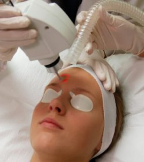 laser skin resurfacing procedure